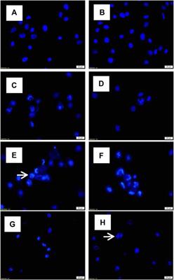 Photodynamic Effects of Thuja occidentalis on Lung Cancer Cells